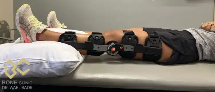 طريقة النوم الصحيحة بعد عملية الرباط الصليبي