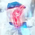 افضل دكتور عظام في التجمع الخامس