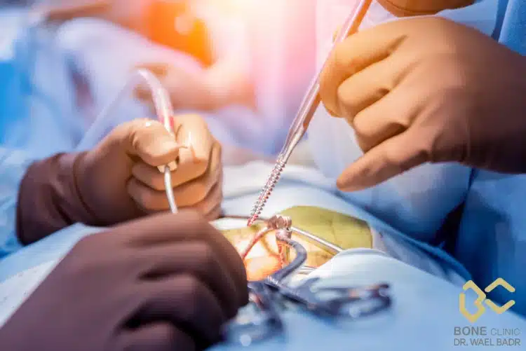  سعر جراحة الرباط الصليبي في مصر