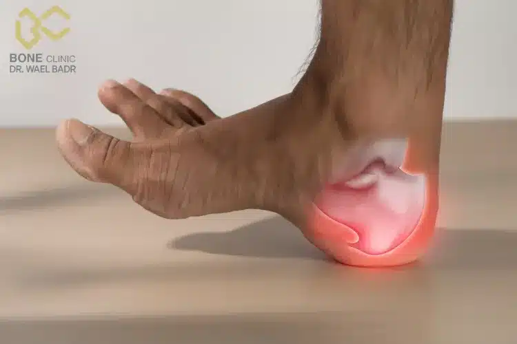 دكتور لعلاج الشوكة العظمية​
