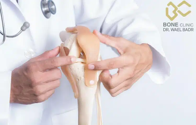 العوامل المؤثرة في تحديد تكلفة عملية ترقيع العظام مصر