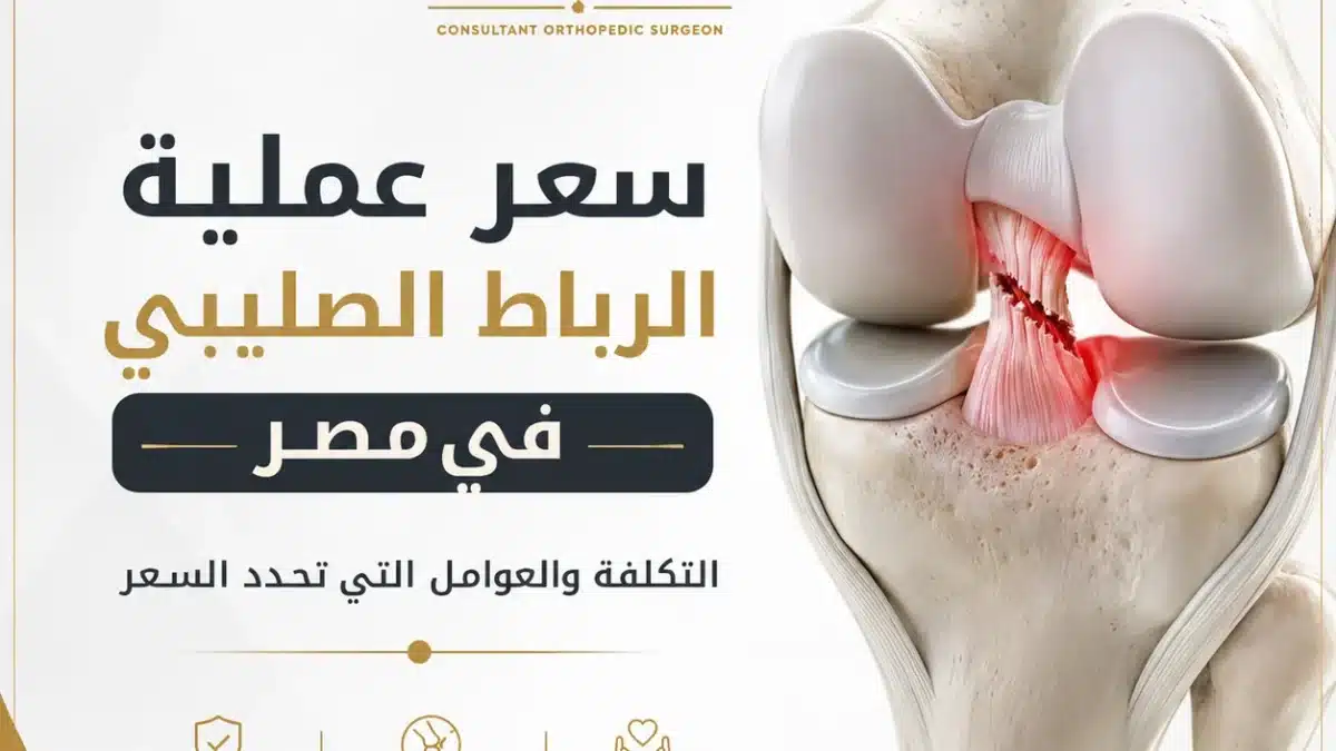 سعر عملية الرباط الصليبي في مصر