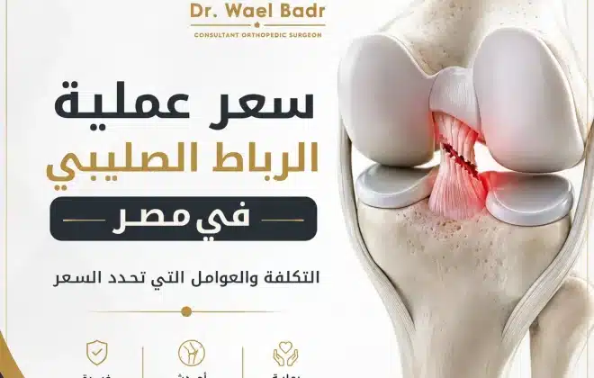 سعر عملية الرباط الصليبي في مصر