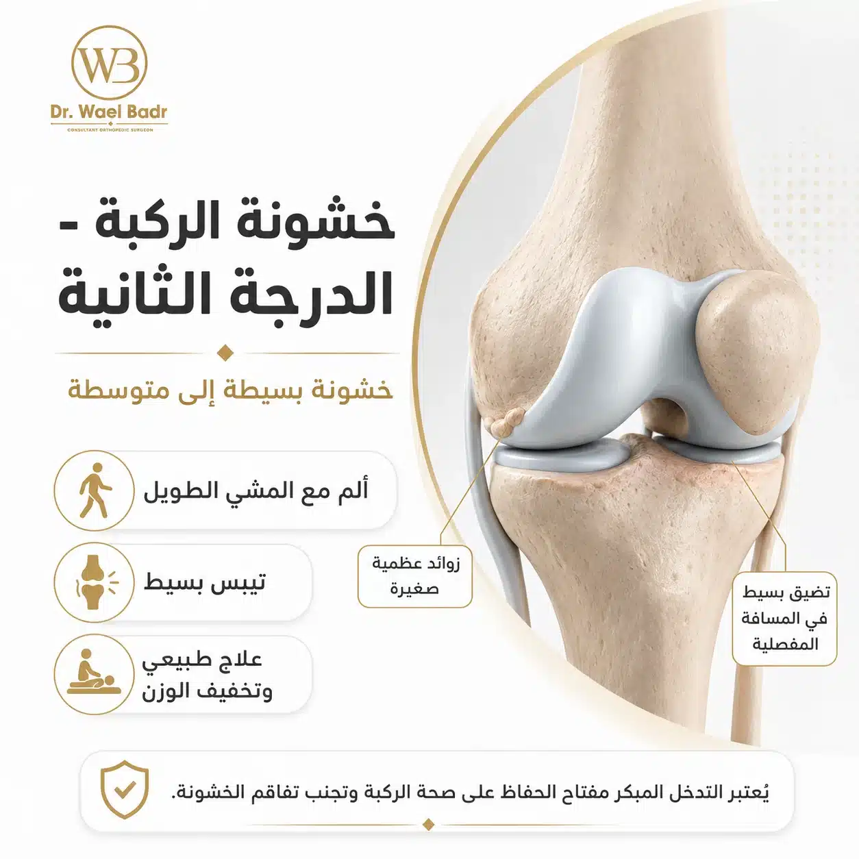 خشونة لركبة من الدرجة الثانية
